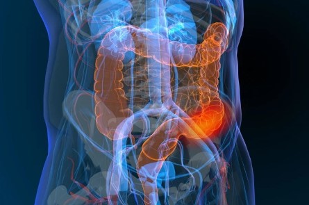 Gastro tract image