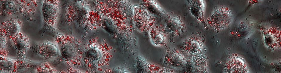 Lipid Droplets